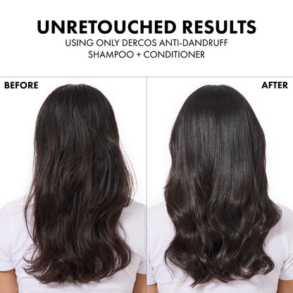 Vichy Dercos Energisant Anti-Hair Loss Hair Cream 200ml - Strengthens & Nourishes Hair