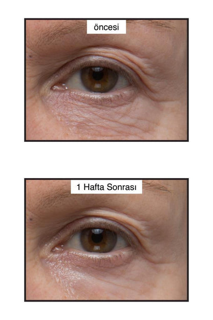 Murad Renewing Eye Cream 15ml - Anti-Aging Moisturizing Eye Cream for Fine Lines & Wrinkles