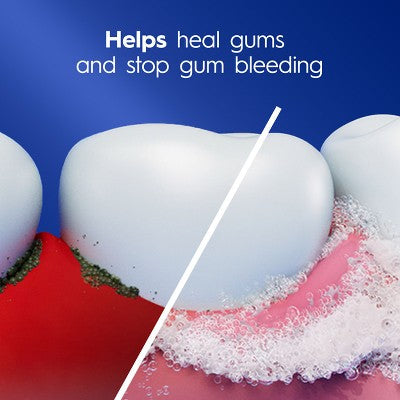 Crest Pro-Health Gum Detoxify Deep Clean Toothpaste 4.8oz/2pk - Missing Box