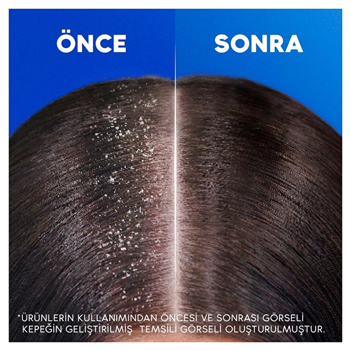 Head & Shoulders Anti-Dandruff Shampoo with Moisturizing Benefits - Dermatologically Tested, 11.16 fl oz