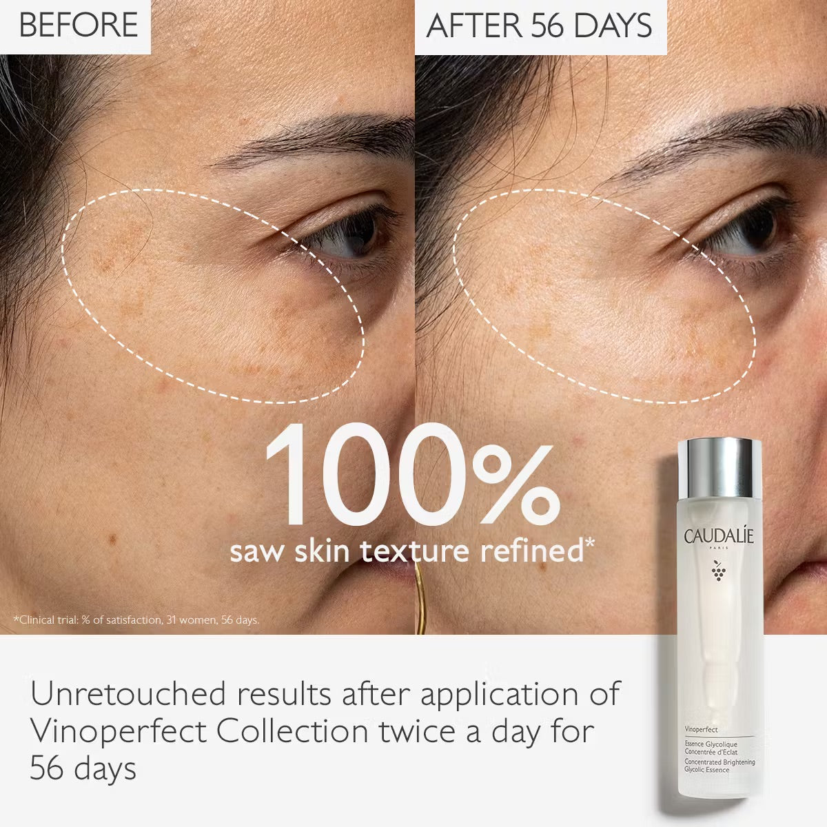 Caudalie Vinoperfect Brightening Glycolic Essence
