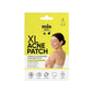 Mia Klinika XL Face & Body Blemish Patches for Breakouts 6-Pack