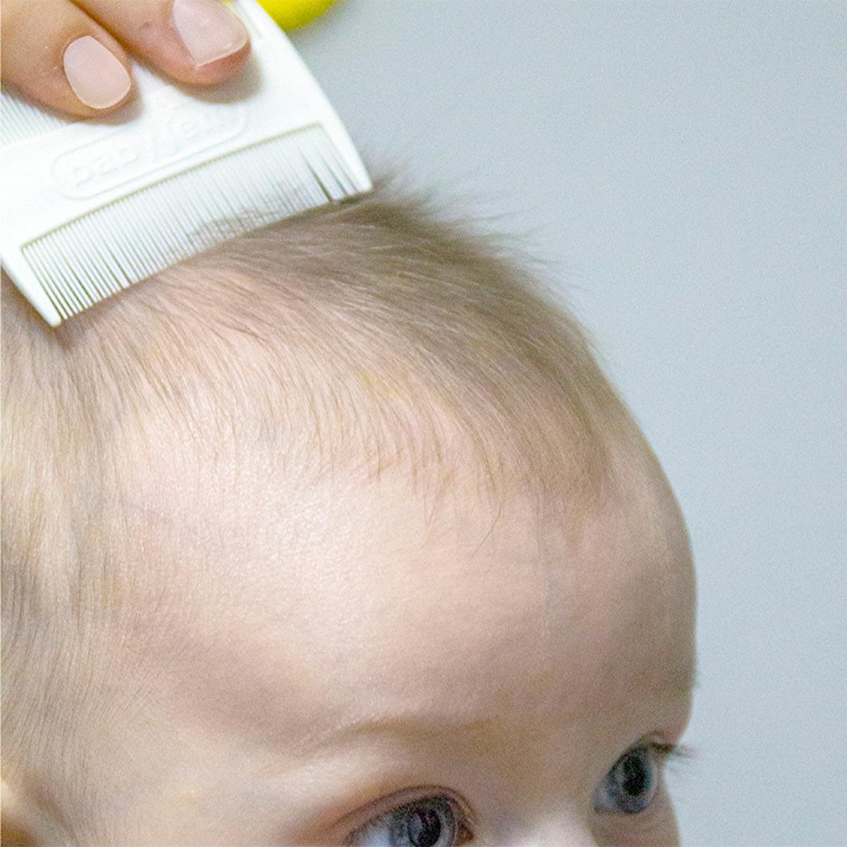 Babyjem Baby Cradle Comb for Gentle Scalp Care - Newborn Grooming Tool for Cradle Cap Removal
